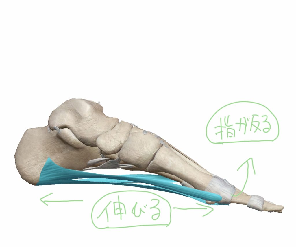 足の指を反らせた際の足底筋膜・足底腱膜の状態の図