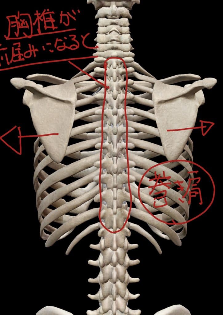 巻き肩の胸郭図