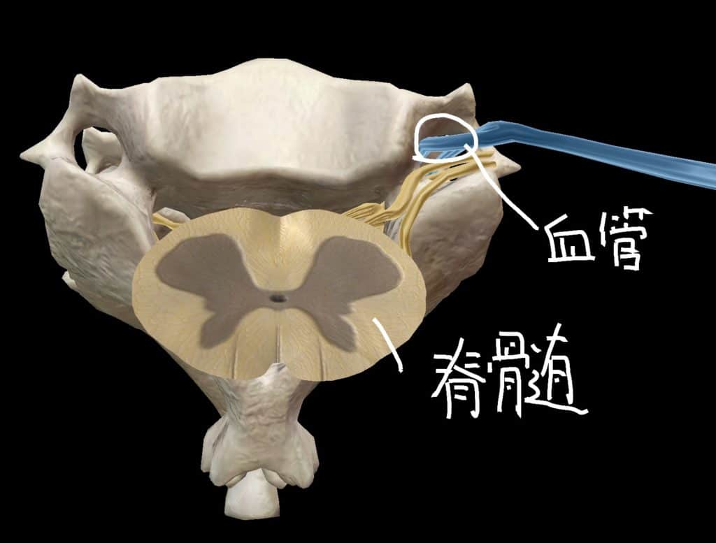頸椎を上から見た際の脊髄・椎骨動脈の位置関係図