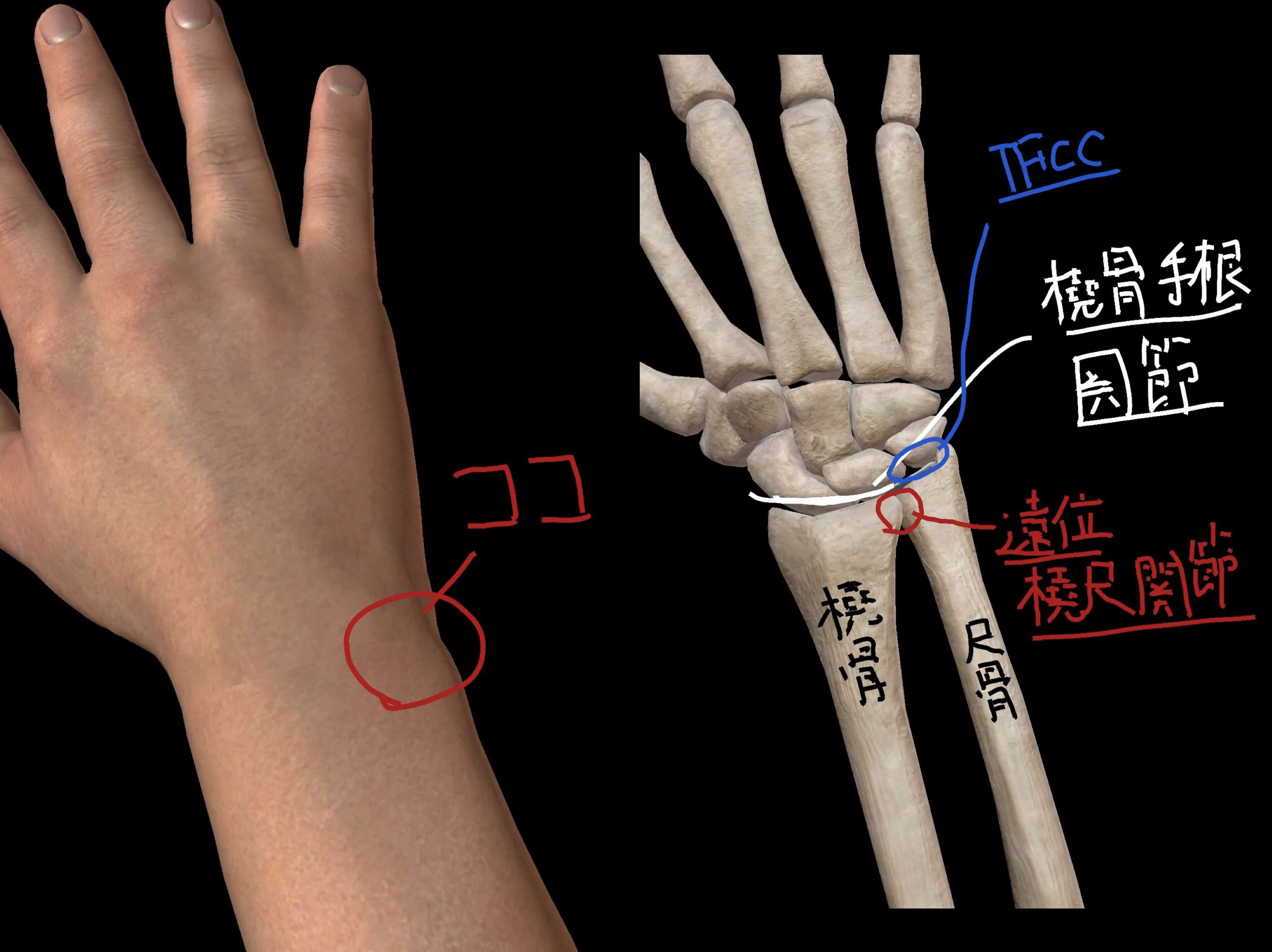 手の関節炎の原因は何ですか?